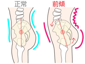 四国中央市でセルライトケアをするTRESORの骨盤の解説